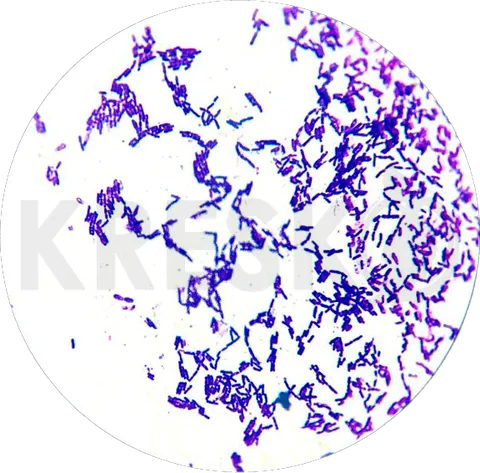 Bacillus thuringiensis al microscopio