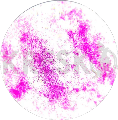 Methylobacterium symbioticum al microscopio
