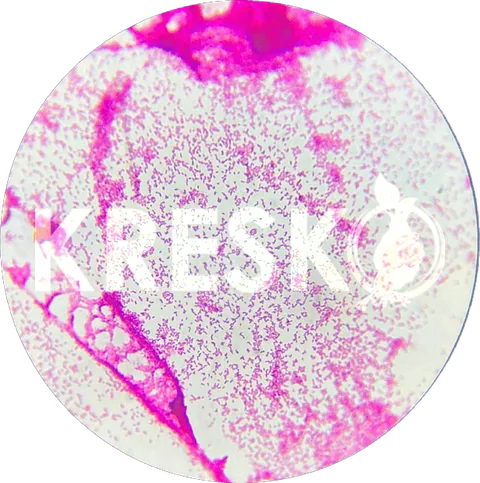 Pseudomonas fluorescens al microscopio