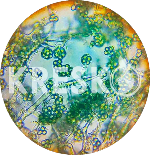 Trichoderma harzianum al microscopio